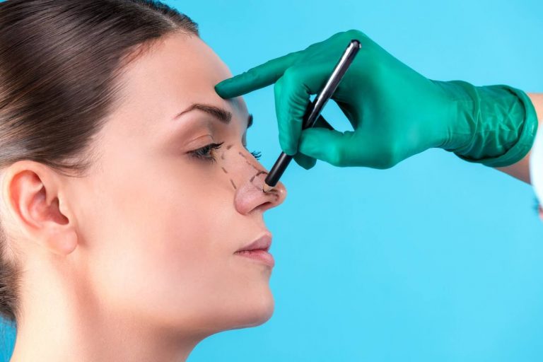mão de médico marcando nariz de mulher para rinoplastia