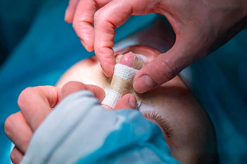 mão de médico com luvas aplicando curativo no nariz do paciente