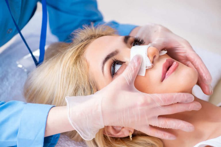 rosto feminino curativo de Rinoplastia - como lavar os cabelos após a rinoplastia?