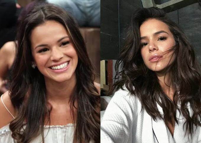 Bruna Marquezine Rinoplastia