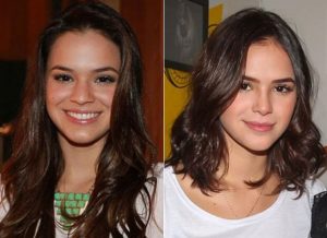 Rinoplastia Bruna Marquezine