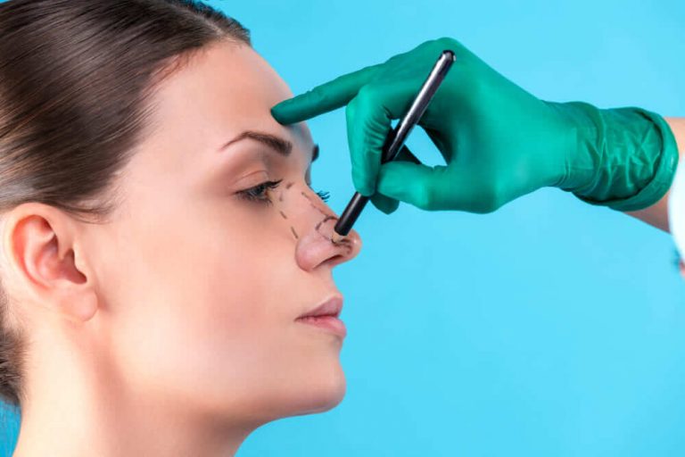 mão de médico desenhando no nariz de uma mulher de perfil para rinoplastia