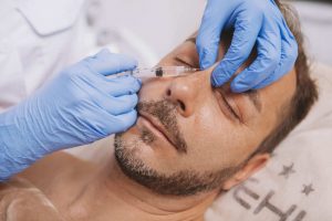 Rinoplastia Masculina