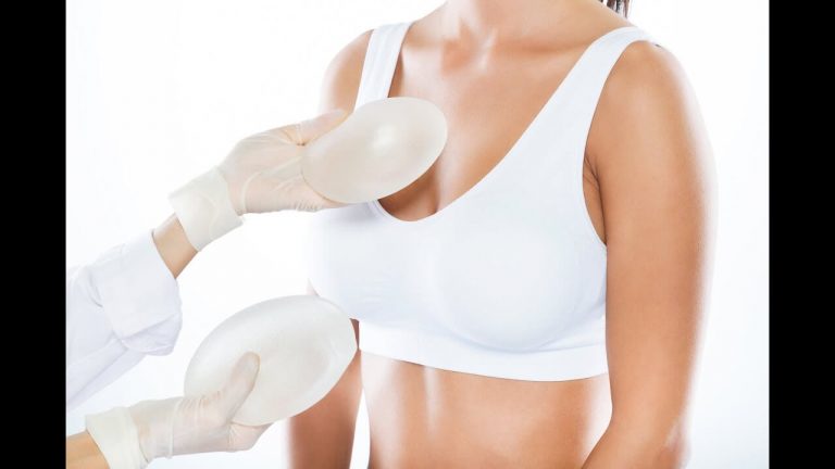 modelo mostrando busto e mãos de medico com próteses de silicone - qual tamanho e modelo ideal das próteses de silicone?