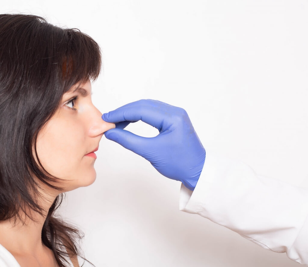 médico apontando nariz de paciente de rinoplastia