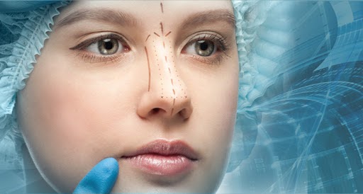 mulher com touca cirúrgica e nariz com marcações para rinoplastia