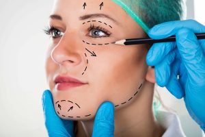 Foto doutor desenhando rosto de uma mulherpara cirurgia de rejuvenescimento facial