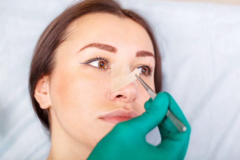 medico removendo curativo do Rosto de mulher - o que fazer no pós de rinoplastia?