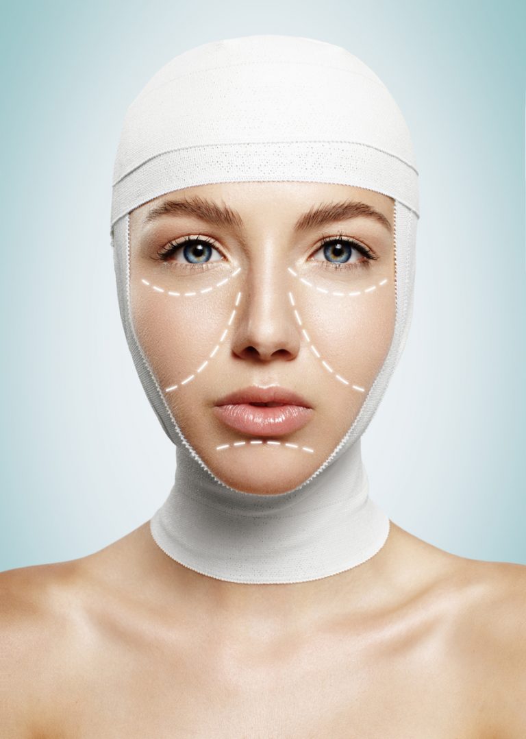 mulher mostrando curativo de facelift - Pós-Operatório do Facelift: Guia Completo da Recuperação Após o Lifting Facial