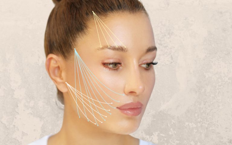 Com Quantos Anos Posso Fazer Facelift? Descubra o Momento Ideal para Rejuvenescer - rosto feminino com desenho de fios mostrando tratamento para bigode chinês facelift lifting-facial-moca-seria-de-perfil-