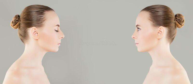 o-nariz-femea-antes-e-depois-da-cirurgia-estetica-ou-retoca