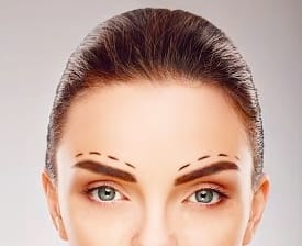 rosto-de-mulher-mostrando-cicatrizes-de-lifting-de-sobrancelhas