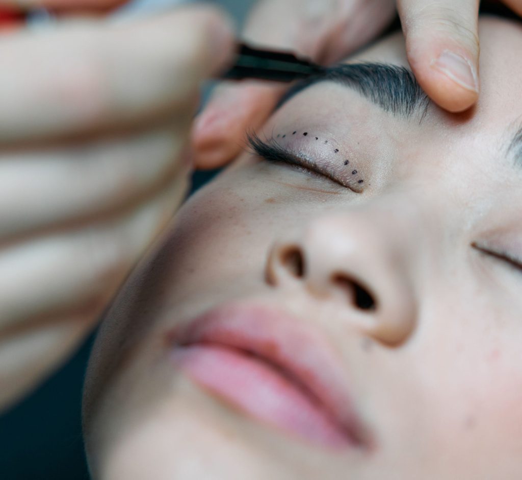Blefaroplastia deixa o olhar arregalado?